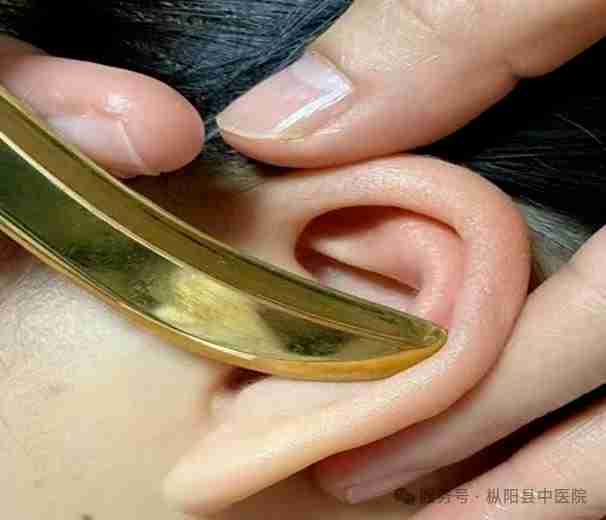 枞阳县中医院中医特色护理门诊开诊