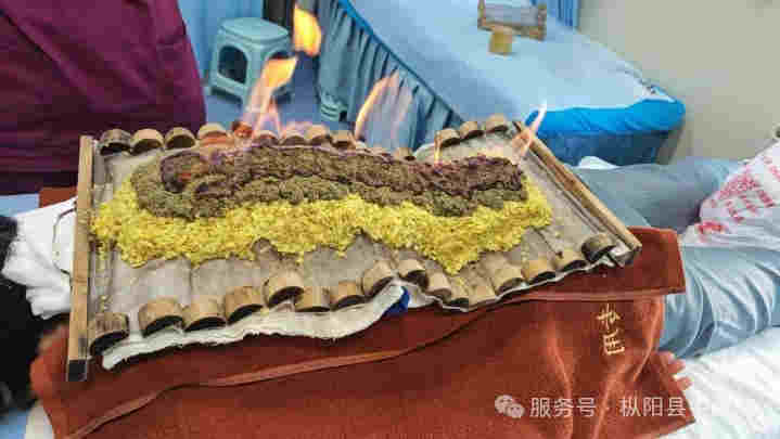 枞阳县中医院中医特色护理门诊开诊啦！